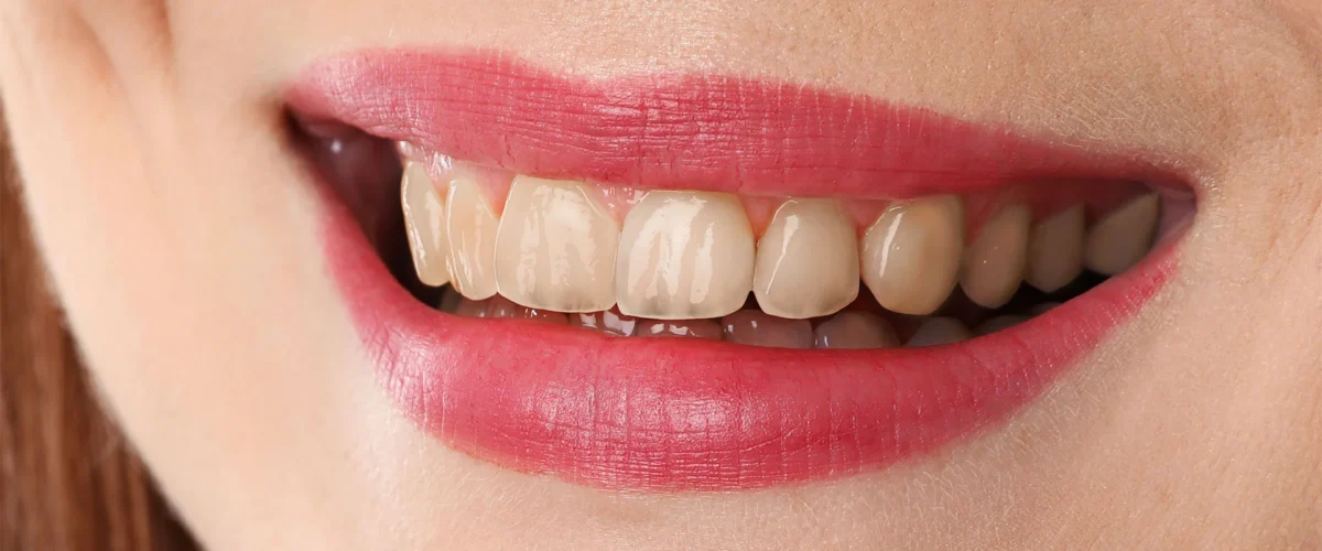 Dental Before 1200x500