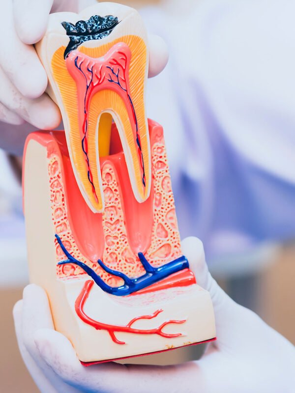 Dental Img17 600x800