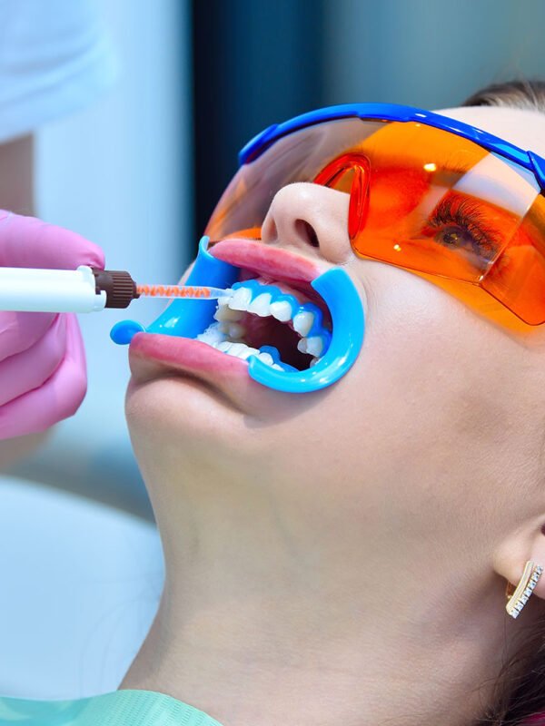 Dental Img18 600x800