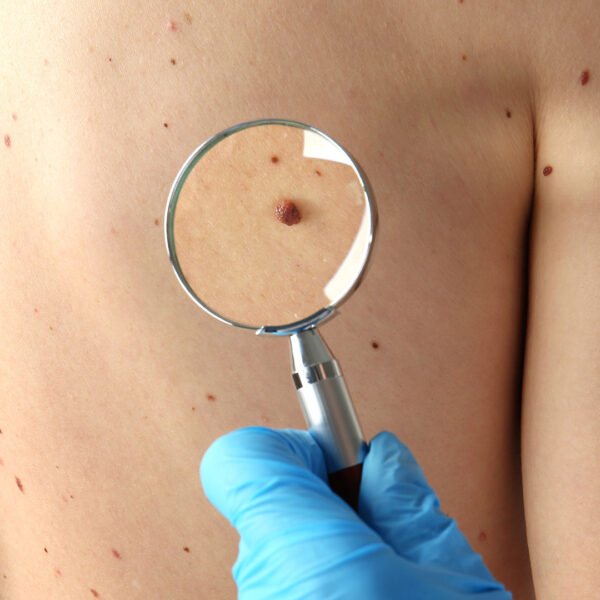 Skin11 600x600