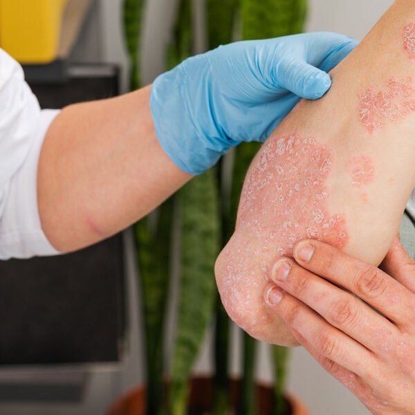 Skin12 600x600