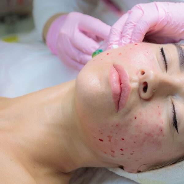 Skin4 600x600